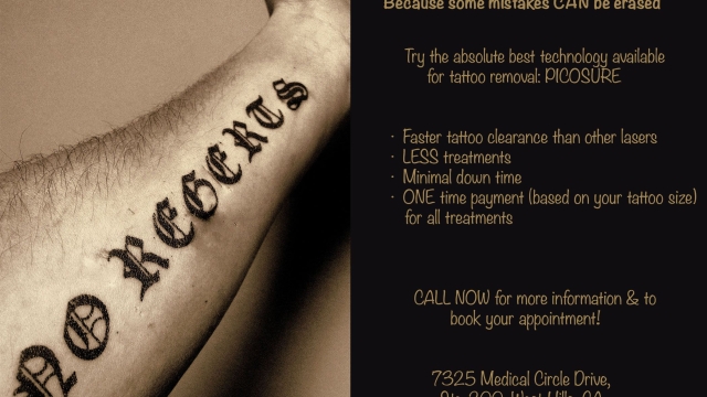 Top Five Reasons For Tattoo Removal